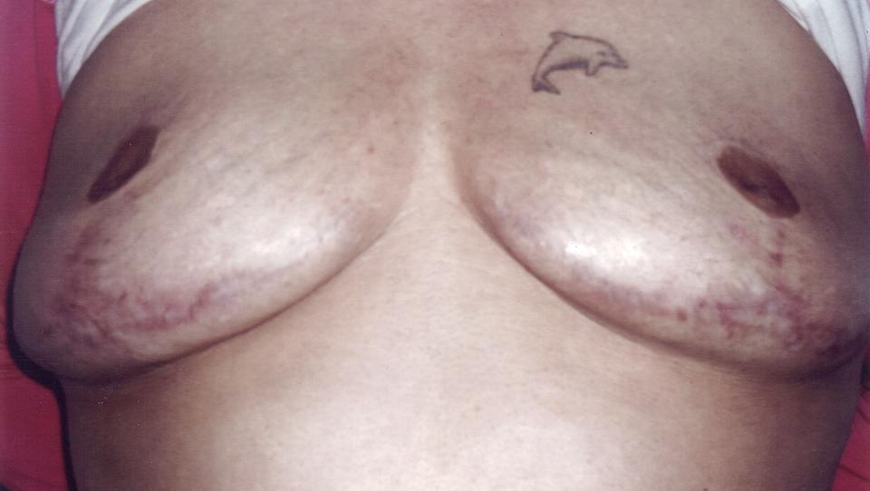 sexkontakter sex etter keisersnitt sexkontakter sex etter keisersnitt