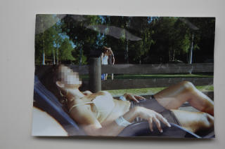 F�R SKADENE: Dette bildet ble tatt av kvinnen (35) f�r hun fikk svovelsyre over hele kroppen. Foto: Privat