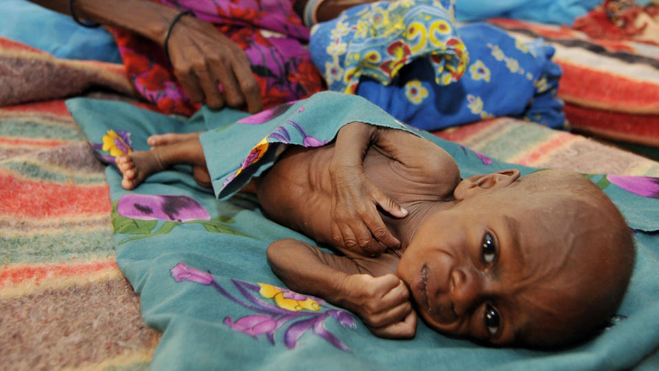 ADVARER MOT SULTKATASTROFE: Hjelpeorganisasjonene Oxfam og Redd Barna ber om 130 millioner kroner for � kunne komme ti millioner mennesker til unnsetning i Vest-Afrika. Situasjonen er verst i Niger. Dette barnet blir tatt vare p� i Tanout s�r i Niger. Foto: AFP PHOTO / SIA KAMBOU / SCANPIX