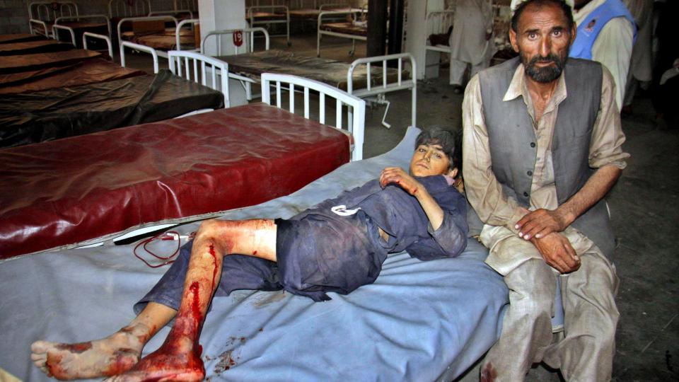 SKADD: En skadd gutt f�r behandling p� et lokalt sykehus etter selvmordsangrepet som kostet opptil 47 mennesker livet i Pakistan. Foto: EPA/ARSHAD ARBAB/SCANPIX