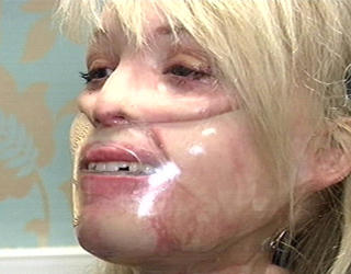 PLASTMASKE: Katie Piper m�tte g� med plastmaske i lang tid etter operasjonene, for � gj�re huden s� glatt og flat som mulig. Foto: STELLA PICTURES