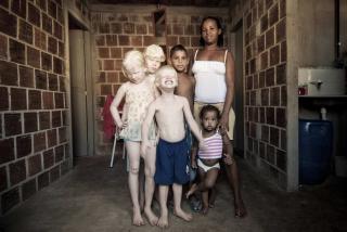 FAMILIEBILDE: Albinos�sknene Esthefany Caroline (til venstre), Ruth Caroline (i midten) og Kauan poserer sammen med deres mor, Rosemere Fernandes, og deres to andre s�sken i slummen i Olinda nord�st i Brasil. Det er h�yst uvanlig at to afro-brasilianske foreldre f�r tre albinobarn som her. FOTO: REUTERS/Alexandre Severo-JC Imagem