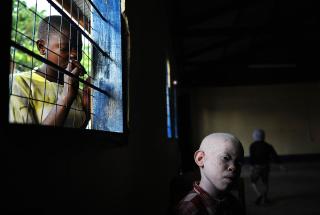 S�STEREN BLE DREPT: Albinoen Mariam Emmanuel (5) fra byen Mwanza i Tanzania ble drept og lemlestet i februar 2008. Hennes ni-�rige bror, Amani, (bildet) fikk plass p� denne skolen for blinde i Tanzania etter at s�steren ble drept. FOTO: AFP/Tony KARUMBA