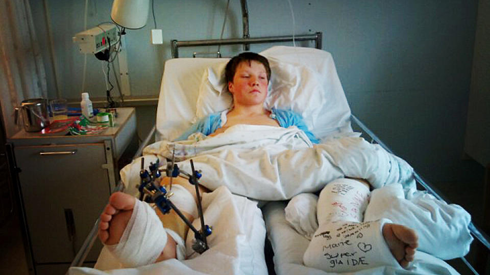 P� SYKEHUS: Kristoffer l� p� sykehus i tre uker etter ulykka i sommer.   Foto: Privat