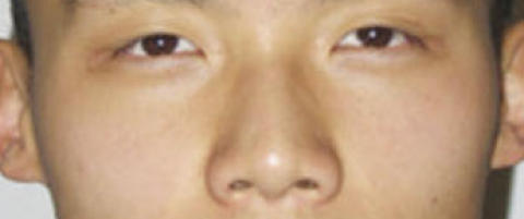 Zhao Fei har forlatt Ungarn