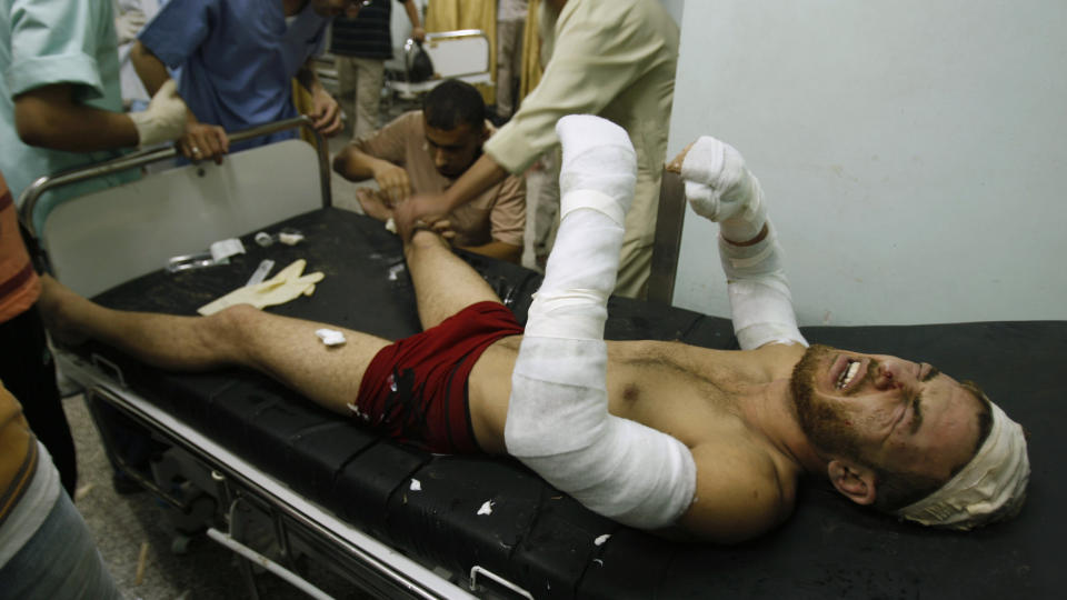 SKJ�R FRED En skadet palestiner f�r behandling p� Abu Youssef Najar sykehuset etter et israelsk luftangrep p� Gazastripen. Foto: REUTERS/Ibraheem Abu Mustafa