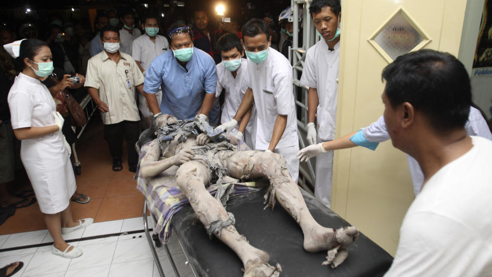  TATT AV ILDEN:  En frivillig, som hjalp til med  evakuering fra foten av Mount Merapi,  kom f�r n�r gl�dende aske og lavasprut og fikk svidd av kl�rne. FOTO: REUTER/SCANPIX.