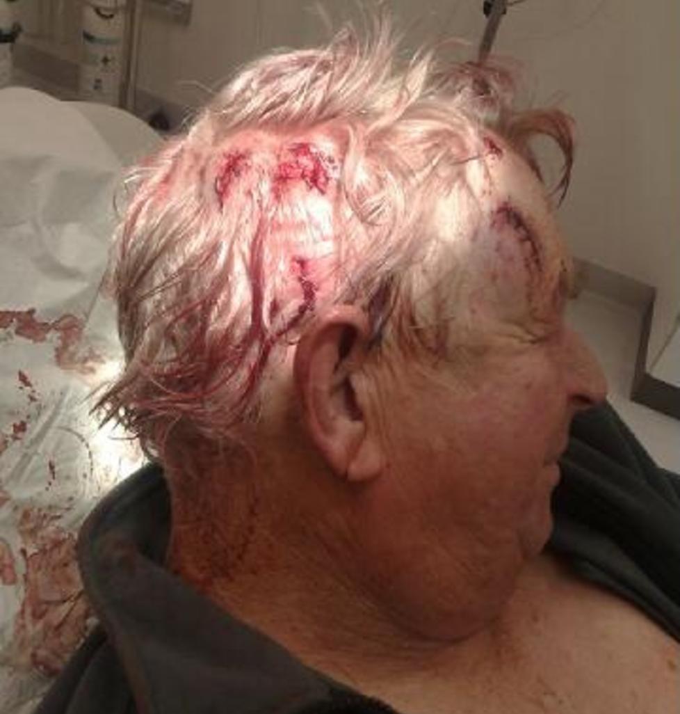 BANKET OPP: Tor Danielsen (65) m�tte til legevakta etter � ha blitt banket opp med en jekkestropp av en ung mann. Foto: Privat