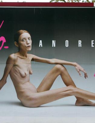 Modellen som ga spise-vegring et ansikt er d�d