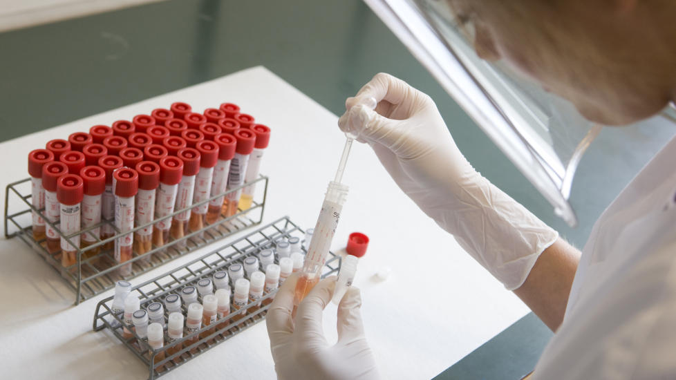 TESTER: Mikrobiologisk laboratorium ved Ullev�l Sykehus tar tester for virus A (H1N1), bedre kjent som svineinfluensa.
Foto: Berit Roald / SCANPIX