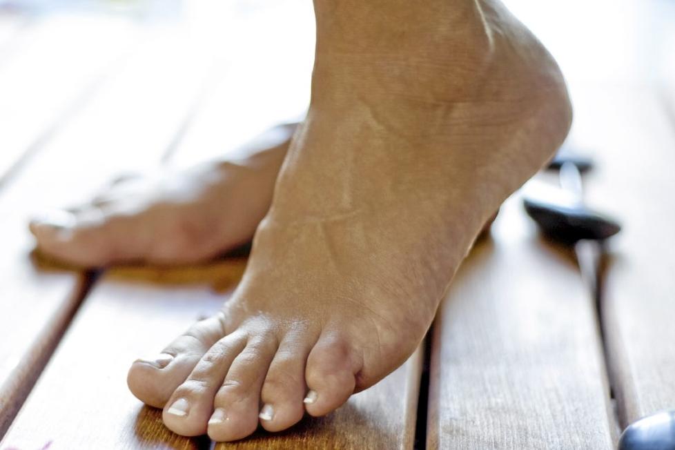 BEHOV FOR FOTPLEIE? T�rr hud er et vanlig problem om vinteren, ogs� p� f�ttene. Foto: Crestock.com