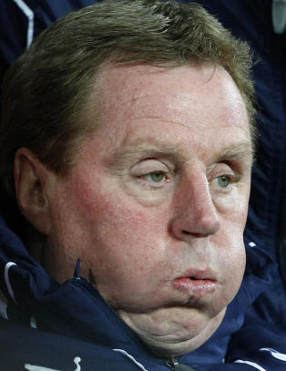 Redknapp anklaget for skattejuks