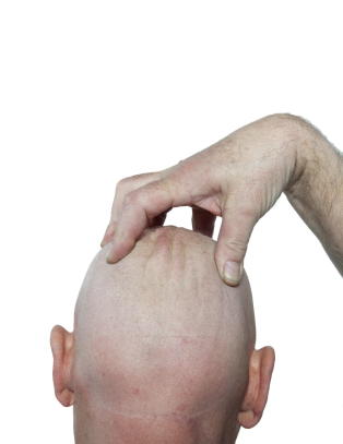 Dette øker risikoen for Alzheimer