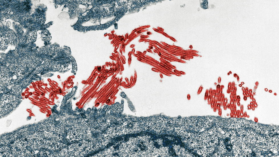  VIRUS:  H1N1-viruset, ogs� kjent som svineinfluensaen, skapte stor frykt. Kanskje kan ny mikroskopteknologi �ke kunnskapen om slike virus i framtiden. Foto: REUTERS/Yoshihiro Kawaoka/University of Wisconsin-Madison.