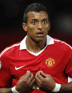 Nani vurderer � forlate United til sommeren