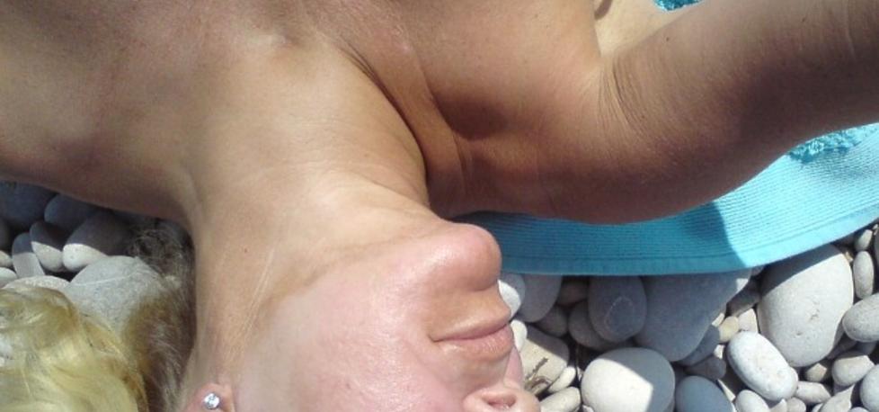 FIKK �DELAGT HUDEN: Tone fikk skjolder i huden og et tydelig skille ved haka etter peeling-behandlingen. N� f�r hun vondt av � v�re ute i sola for lenge, og bruker mye sminke. &mdash;Jeg f�ler at livskvaliteten har blitt forringet, sier hun. Les mer om Tone nederst i saken. Foto: Privat
