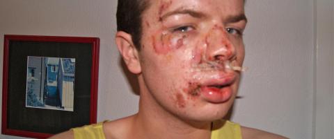 - Sl�tt ned fordi jeg er homofil