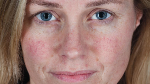 FOR UNICEF:  Solveig Kloppen