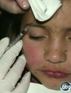 Britney (8) fikk botox- behandling av moren