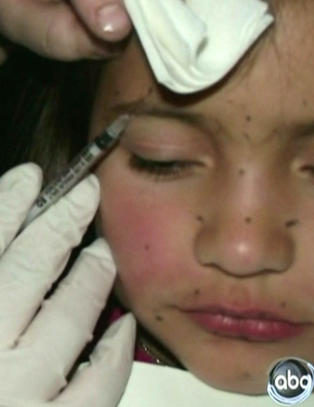 Britney (8) fikk botox- behandling av moren