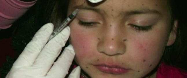 Britney (8) fikk botox- behandling av moren