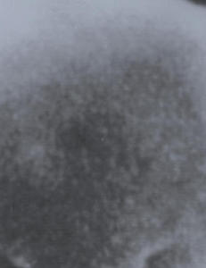 Forskere stadig n�rmere l�sning p� aidsg�ten