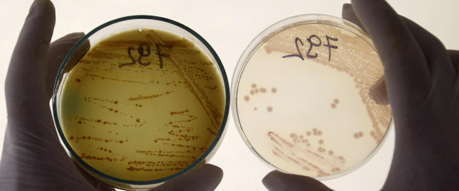 Tysk to�ring d�d av E. coli-infeksjon