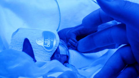 DRAMATISK:  For m�dre til ekstremt premature er det t�ft og en helt annerledes opplevelse.  Foto: privat