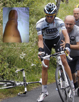 Dette kan �delegge alt for storfavoritten Contador