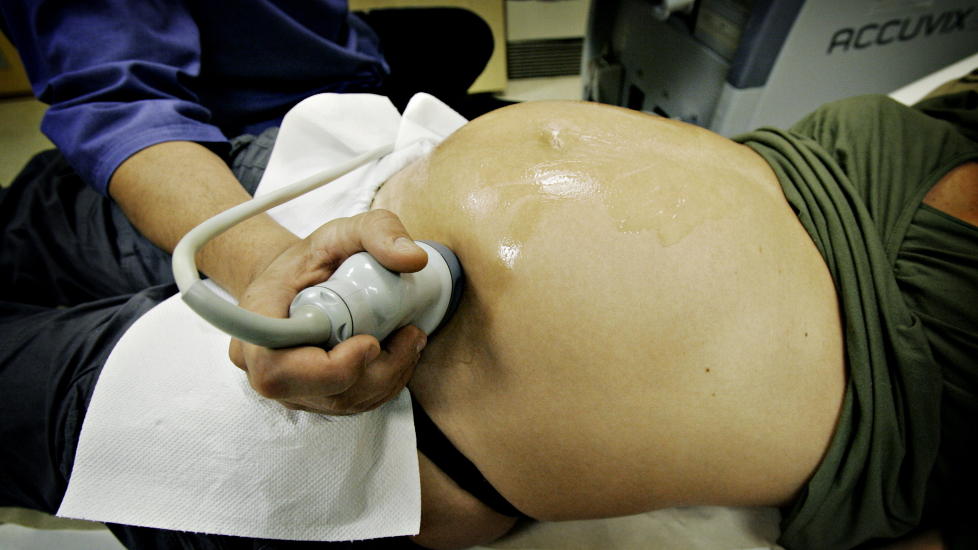  ULTRALYD:  Svangerskapsdiagnostikk kan gi svar - og muligheter for vanskelig valg. ILLUSTRASJONSFOTO: JON TERJE H. HANSEN/DAGBLADET.