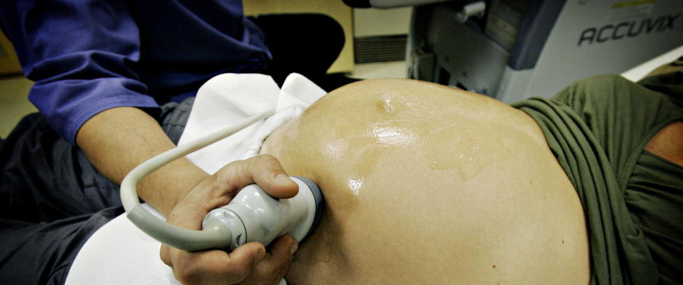 Velger bort fostre med Downs syndrom
