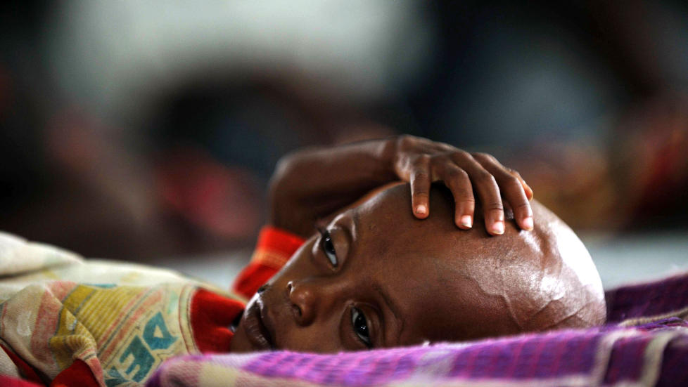 KRITISK: Somaliske barn lider av t�rke og sult. Katastrofen �ker for hver dag som g�r. Alle oppfordres til � gi en hjelpende h�nd til 11 millioner mennesker som er rammet p� Afrikas Horn. Foto:  AFP PHOTO/Roberto SCHMIDT