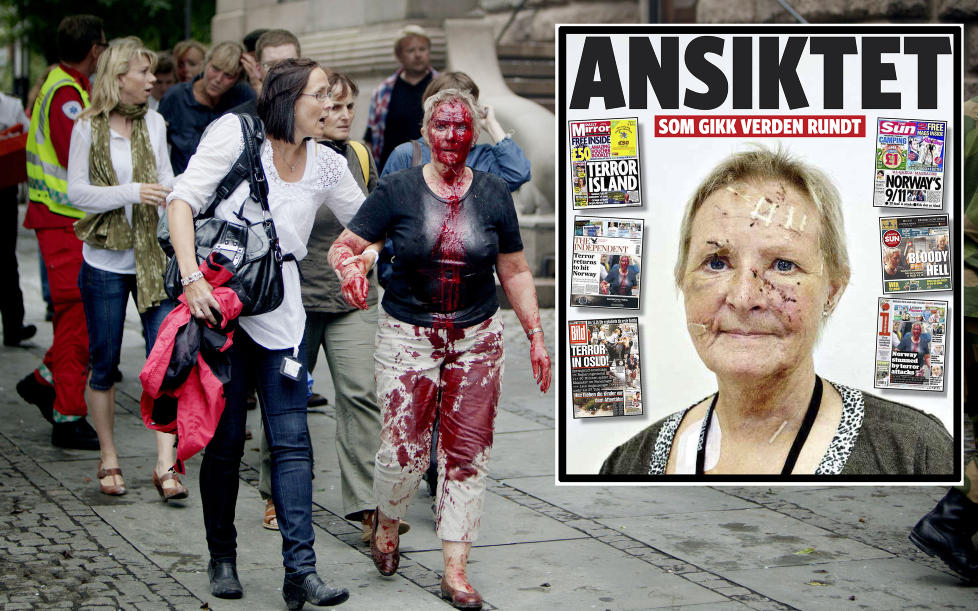 <b>TERRORENS ANSIKT:</b> Sissel Wilsgård ble hardt skadd av Breiviks bombe. Bilder av henne gikk verden rundt.