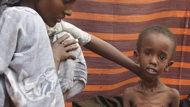 AVMAGRET: En kvinne ser til sitt underern�rte barn i en leir i Mogadishu. Foto: AP Photo/Farah Abdi Warsameh