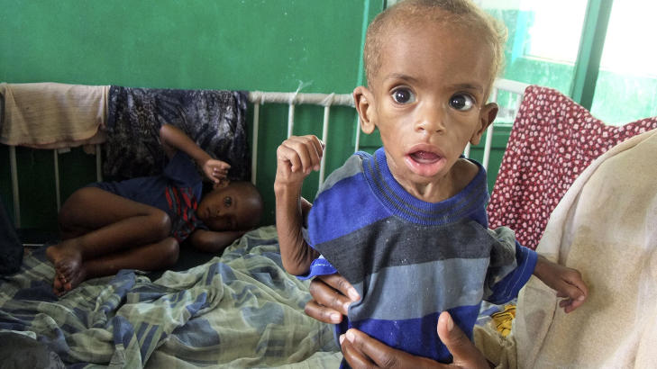 VERST FOR DE MINSTE: De minste barna er mest utsatt n� som regnet kommer. De er utsultet og har d�rlig immunforsvar. Diar� er en hyppig d�ds�rsak blant spebarn. Foto: AP Photo/Farah Abdi Warsameh