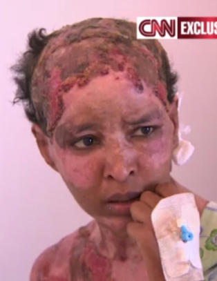 - Kadhafi-familien torturerte barnepike med kokende vann