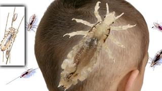 BEVEGER SEG RASKT: Voksne lus er bare 2-3 mm lange. De kan være alt fra lyse, nesten gjennomsiktige til mørkebrune. Foto: www.colourbox.com BEVEGER SEG RASKT: Voksne lus er bare 2-3 mm lange. De kan være alt fra lyse, nesten gjennomsiktige til mørkebrune. Foto: www.colourbox.com