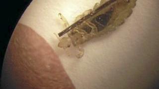EN LITEN RAKKER: Den lille skapningen er ufarlig, men ekkel, mener de fleste. Og den kan være vanskelig å bli kvitt. Foto: Organisasjonen Lusfri Norge EN LITEN RAKKER: Den lille skapningen er ufarlig, men ekkel, mener de fleste. Og den kan være vanskelig å bli kvitt. Foto: Organisasjonen Lusfri Norge