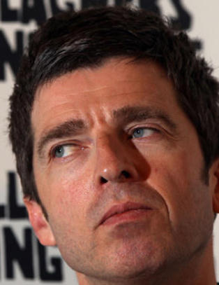 Oasis-Gallagher hudfletter Tevez