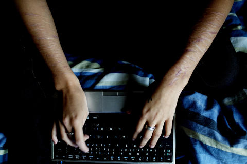 FORTELLER P� NETT: - Mange skj�nte at noe var galt, s� det verserte flere rykter f�r jeg startet bloggen, sier Anne.