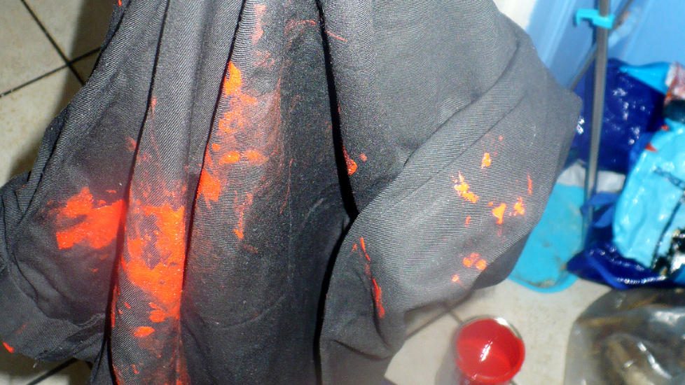 INGEN LURING:  Svindleren sendte inn dette bildet til forsikringsselskapet i h�p om � f� erstatning etter at han selv hadde lekt med kosten. Foto: UTL�NT AV EUROPEISKE REISEFORSIKRING