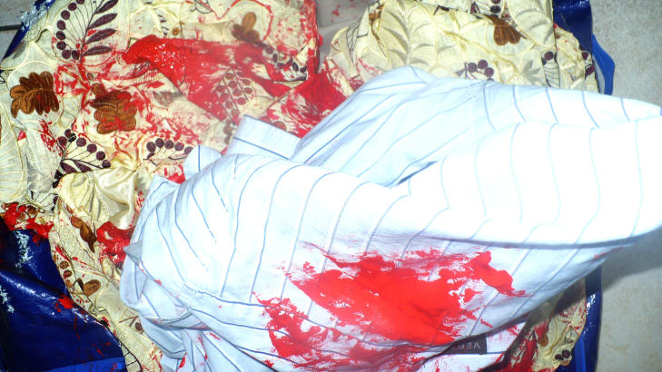 NY MALING: Mye tydet p� at kl�rne var p�f�rt maling i ettertid da mannen skulle dokumentere skadene. Foto: UTL�NT AV EUROPEISKE REISEFORSIKRING