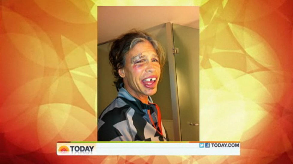 SLO SEG I ANSIKTET I DUSJEN: Aerosmith-rocker Steven Tyler fikk en magesykdom etter mat han ikke t�lte og en tur med inkaer i Paraguay. Foto: Stella Pictures