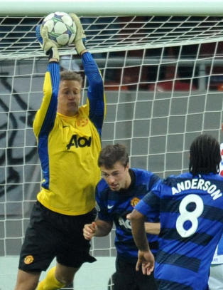 Ville kuttet av seg armen for United-kontrakt