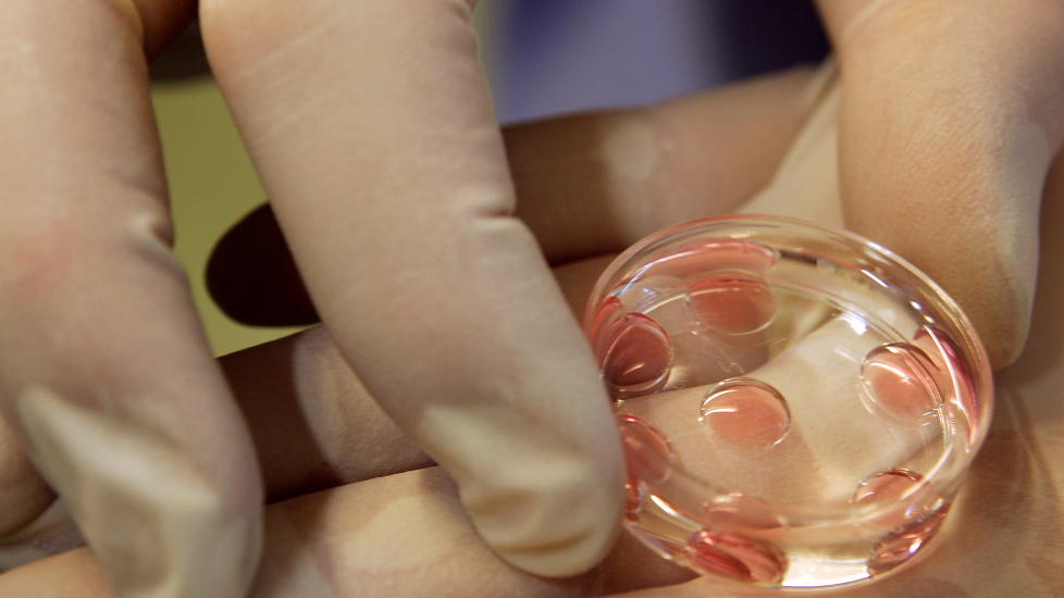 EGGDEBATT: Her gj�r en lege p� en fruktbarhetsklinikk klar egg og s�d for en kunstig befruktning. N� er det slik at norske par som trenger eggdonor m� dra til utlandet.Foto: SCANPIX/REUTERS/ALESSANDRO BIANCHI