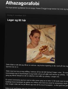 Therese-Louise ventet 10 uker på kreftbehandling