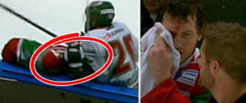 - Jeg har sydd noen sting og er litt bl� i trynet