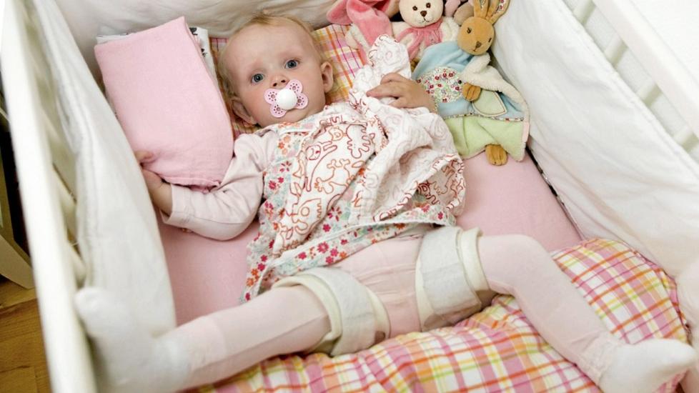 BEINT�FF BARNDOM: F�rst etter 6 m�neder fikk Ariel stilt diagnosen hoftedysplasi. Foto: Anne Elisabeth N�ss