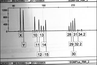 DNA-ANALYSE: DNA-ekstraktene har g�tt igjennom elektroforeseinstrumentet hvor DNA blir lest av. Elektroferogram (EPG) viser resultatet av DNA-analysen, som topper i en graf. X og Y viser at det er DNA fra en mann i pr�ven. Tallene viser at det er bidrag fra tre menn i pr�ven. Foto: Lise �serud / Scanpix