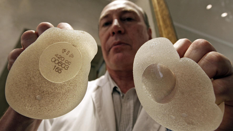  ADVARER: : Plastisk kirurg Denis Boucq i Nice viser fram de onstridte brystimplantetene PIP (Poly Implant Prothese) som n� er blitt avdekket solgt under navnet M-Implants.Interpol jakter den franske grunnleggeren av konkursrammede PIP, og helsemyndighetene i blant annet Franrkike har g�tt ut med oppfordring til kvinner om � fjerne dem  FOTO: REUTERS/Eric Gaillard/SCANPIX.